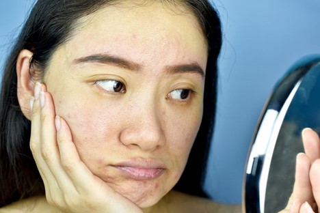 Poor Gut Affects Skin