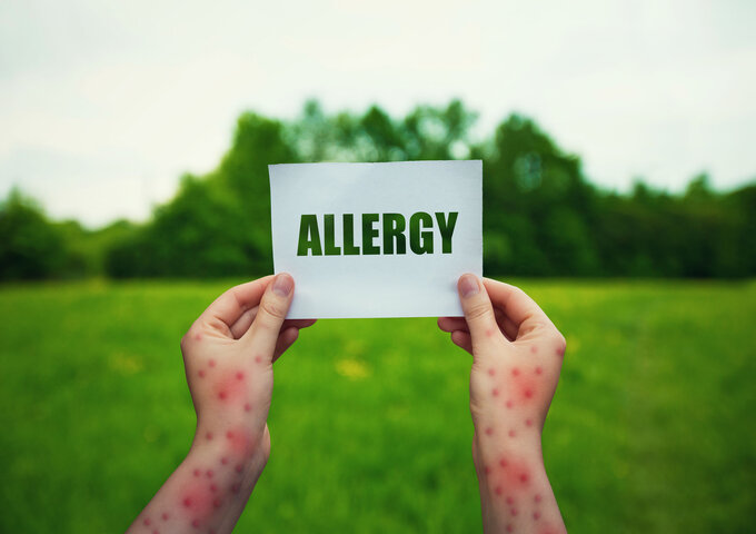 What are the common causes of allergies